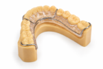 Hawley Retainer - Image 2