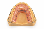 Wrap-Around Retainer