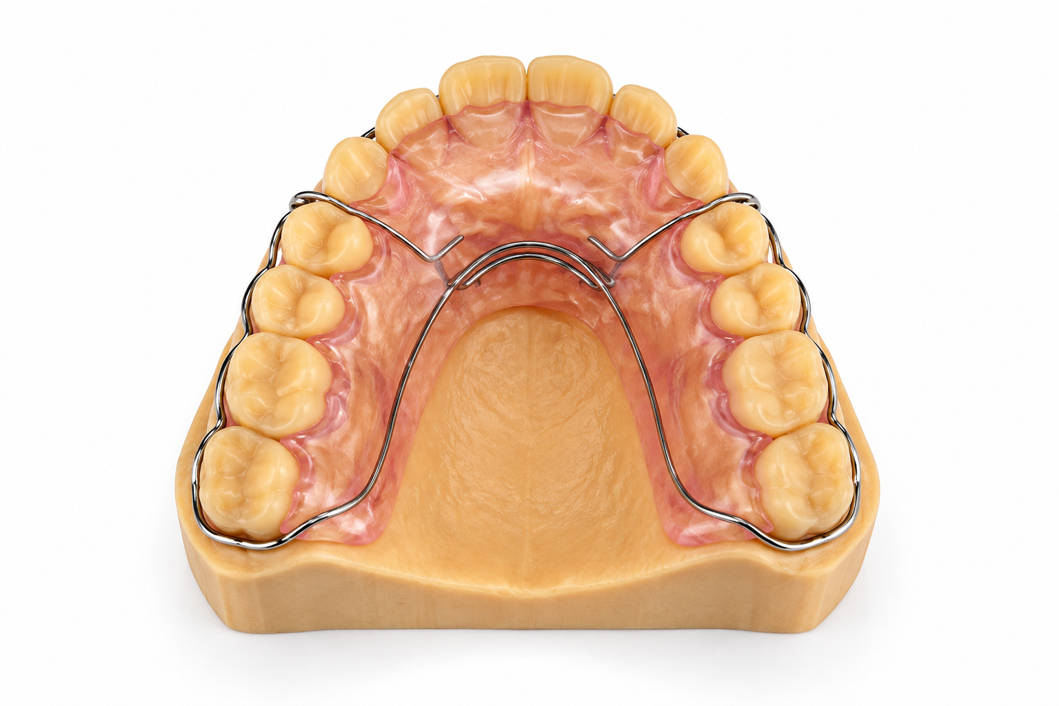 732b010c2417062f9fc47e689c7cbb46 Wrap-Around Retainer - Image 1