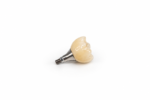 Implant Crown Restoration - Image 3