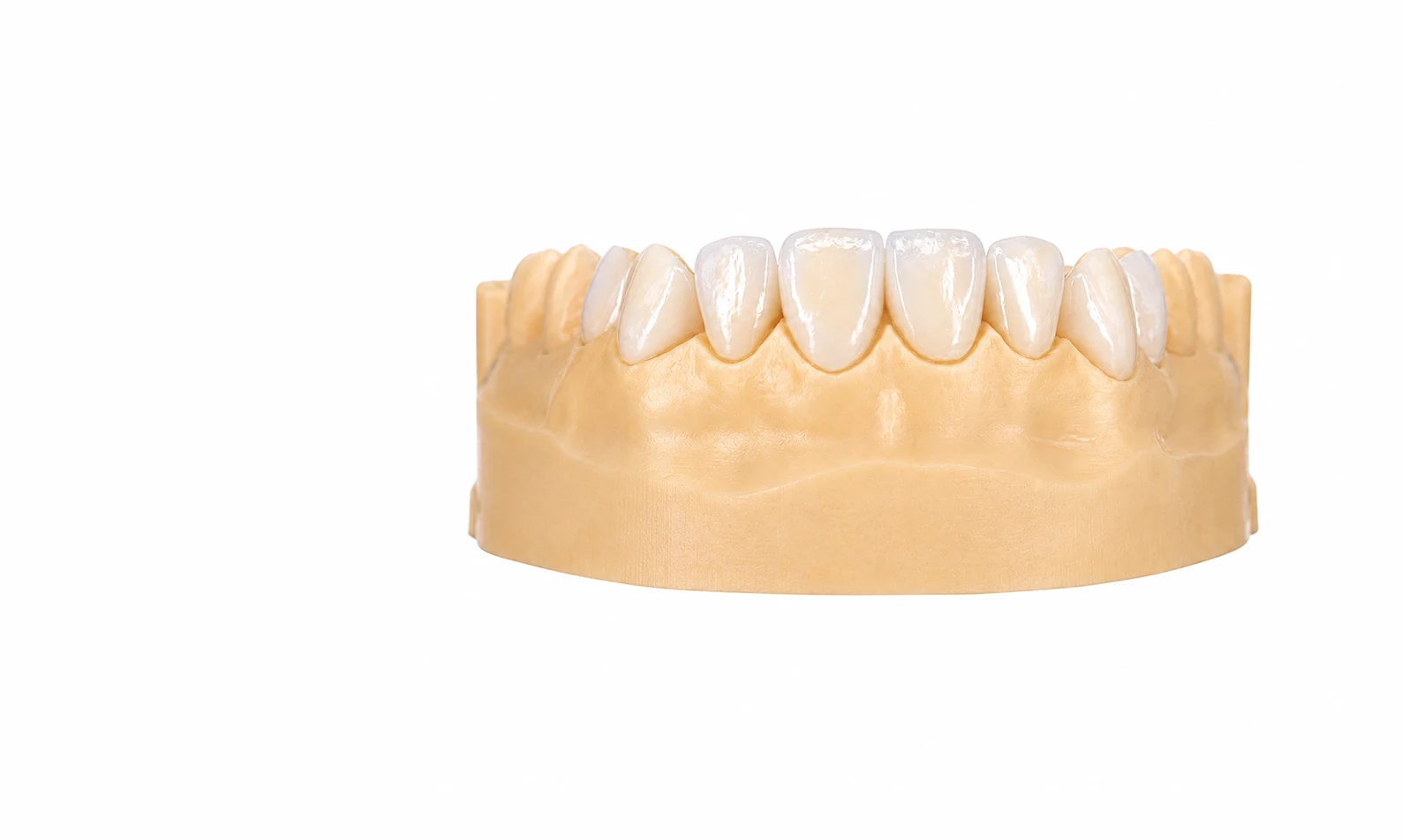 Veneers & Aesthetics Dental Model