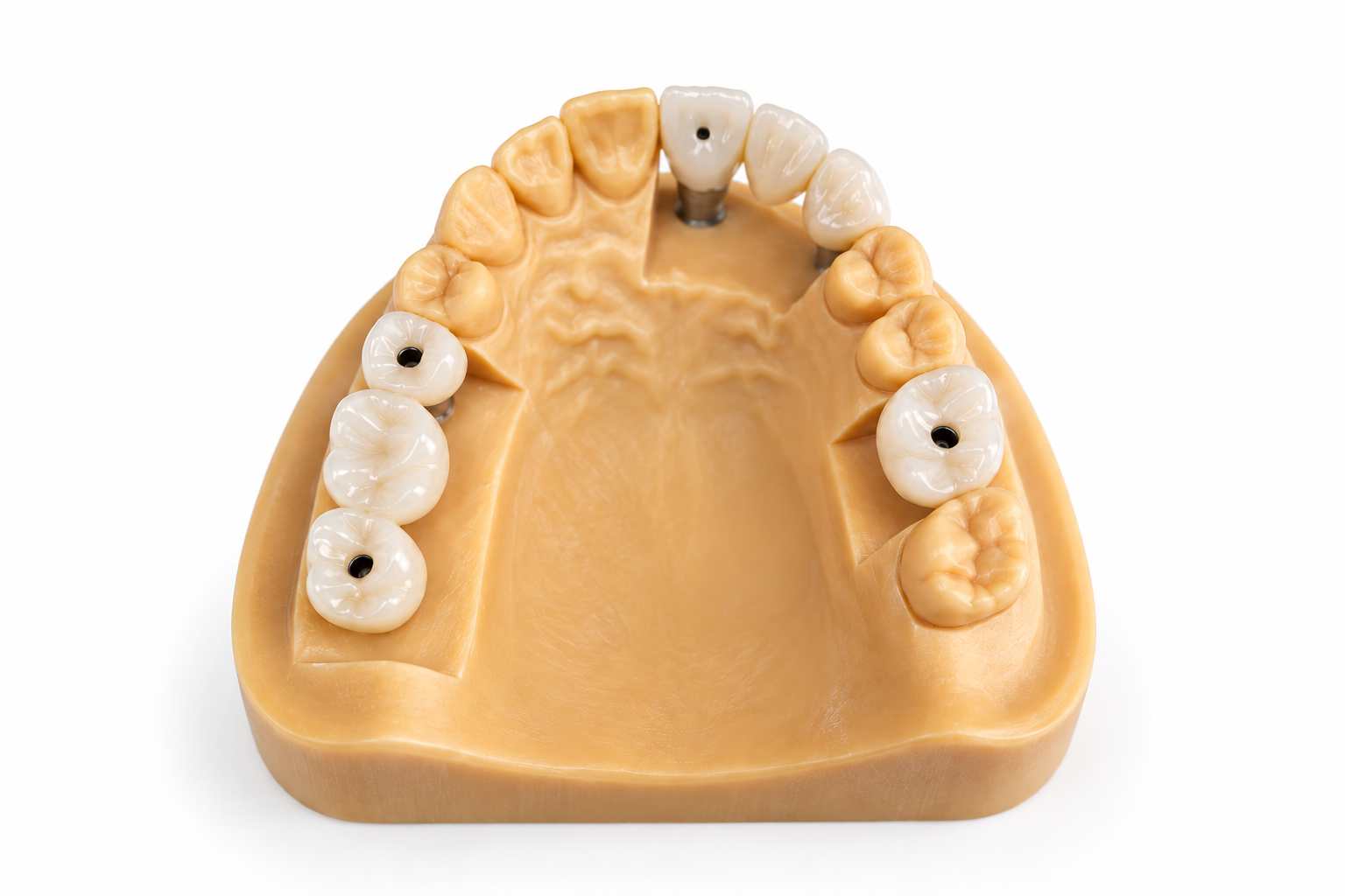 85c768db0b7568e1a889417765d969c3 Implant Crown Restoration - Image 1