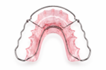 Wrap-Around Retainer - Image 2