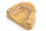 Hawley Retainer