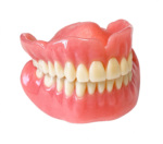 Conventional Complete Dentures