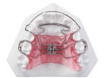 Removable Expansion Plates - Image 3