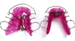 Active Plates - Image 3