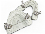 Fixed Bite Correctors