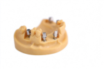 Custom Implant Abutments - Image 3