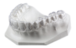 Clear Retainers - Image 4