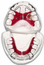 Active Plates - Image 2