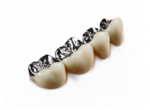Zirconia Fixed Bridges - Image 4
