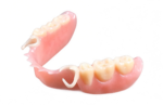 Flexible Partial Dentures with Tooth-Colored Clasps