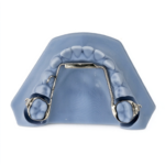 Lower Lingual Holding Arches - Image 2