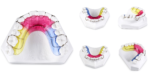 Hawley Retainers - Image 2