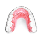 Wraparound Retainers - Image 3