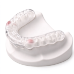 Dual-Laminate Night Guards - Image 2