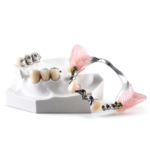 Precision Attachment Partial Dentures - Image 4