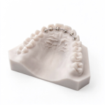 Fixed Lingual Retainers - Image 2