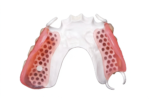 Custom PEEK Dental Components - Image 3