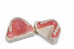 Digital Complete Dentures - Image 2