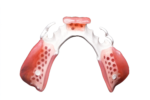 Custom PEEK Dental Components - Image 2