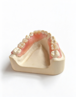 Temporary Acrylic Partial Dentures - Image 2