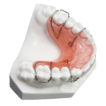 Hawley Retainers