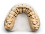 Porcelain Veneers