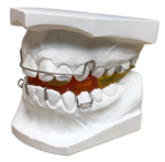 Functional Orthodontic Appliances - Image 3