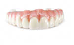 Full-Arch Zirconia Restorations - Image 2