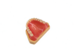 Acrylic Partial Dentures - Image 4