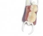 PEEK Implant-Supported Prosthetic Frameworks - Image 2