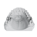 Transpalatal Arch (TPA) - Image 3