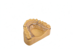 Hawley Removable Orthodontic Appliances - Image 3