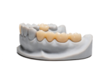 One-piece construction eliminates a separate porcelain veneer and its associated chipping risk. - Image 2
