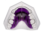 Removable Expansion Plates - Image 2