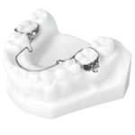 Lingual Arch Appliances - Image 3