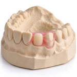 Flexible Resin Partial Dentures
