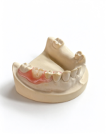 Temporary Acrylic Partial Dentures - Image 3