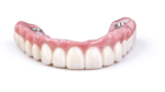 PMMA Full-Arch Provisional Restorations - Image 4