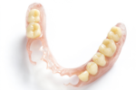 Flexible Partial Dentures with Tooth-Colored Clasps - Image 4